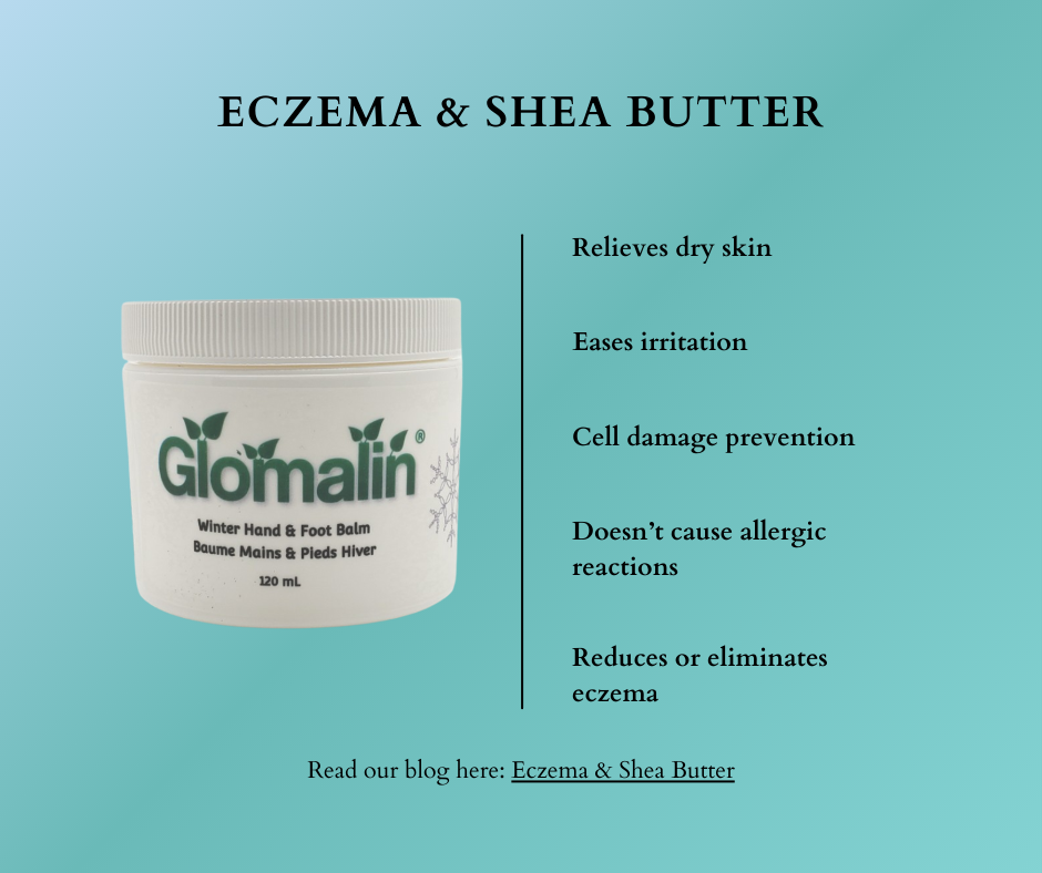 Eczema & Shea Butter